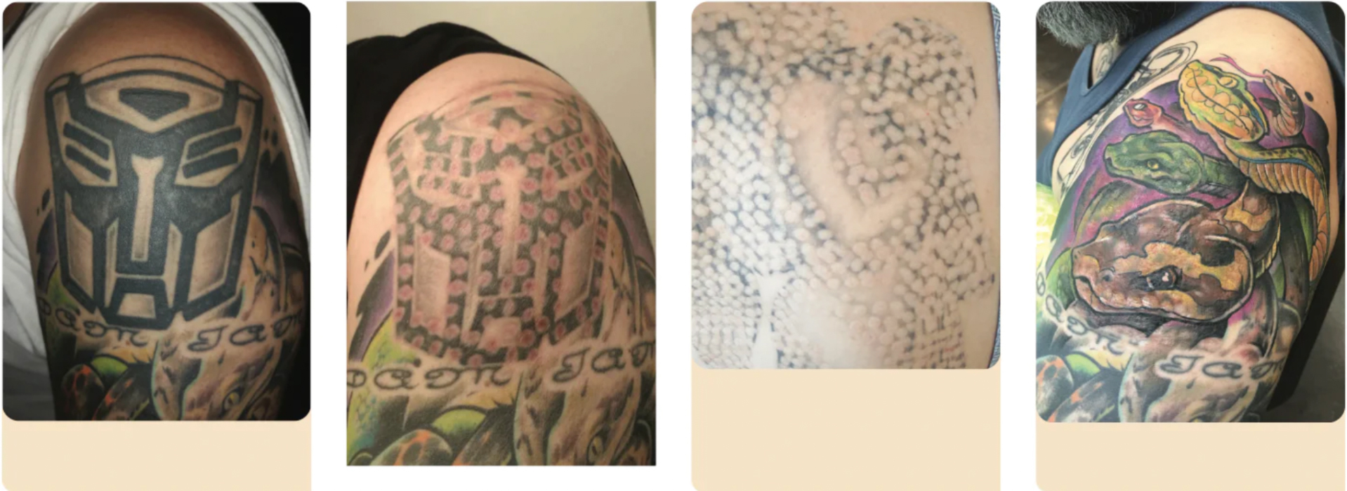 Tattoo Cover Up Calf Sleeve - White