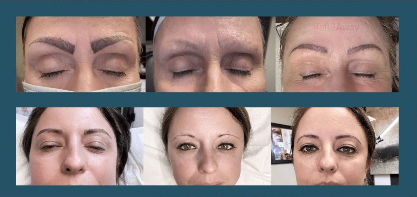 Conference Befores and Afters