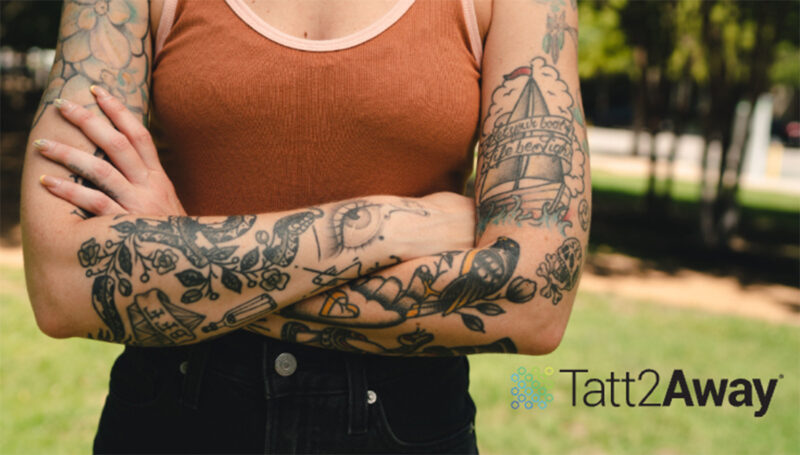 tattoo removal methods types and processes