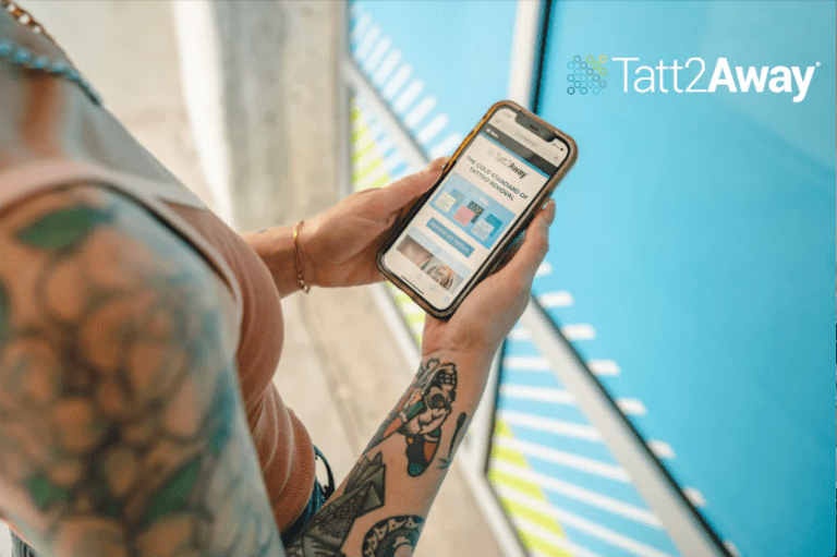 Easy & Simple Tattoo Removal Cost Calculator Tatt2away®