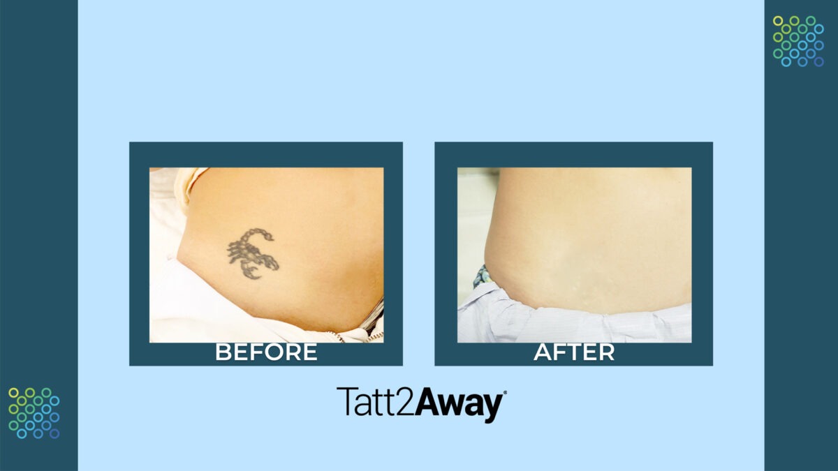 Everything You Need to Know About Color Tattoos Tatt2Away