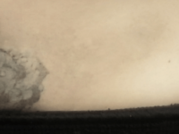 after a tattoo removal