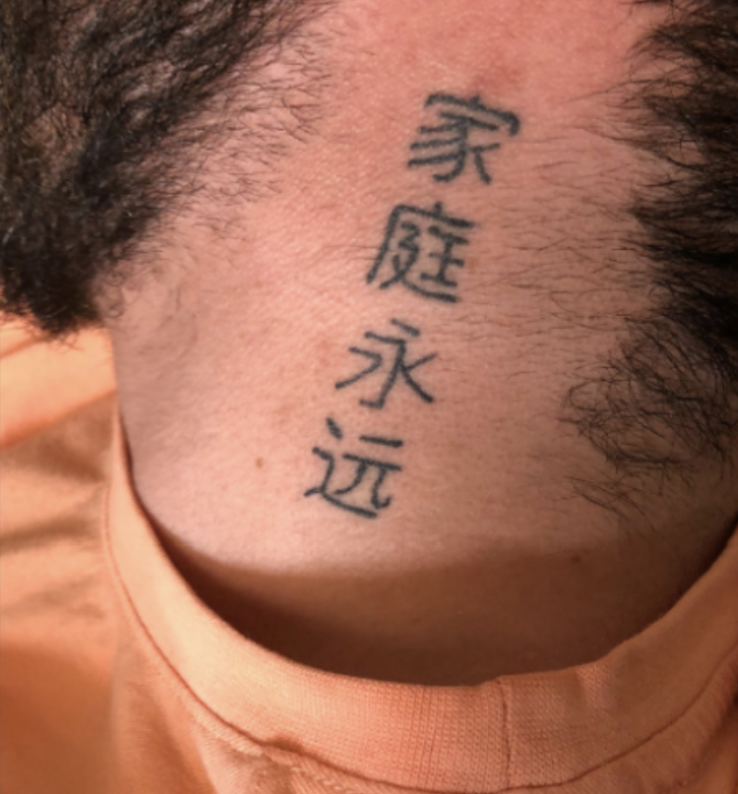 before removal of chinese word tattoo
