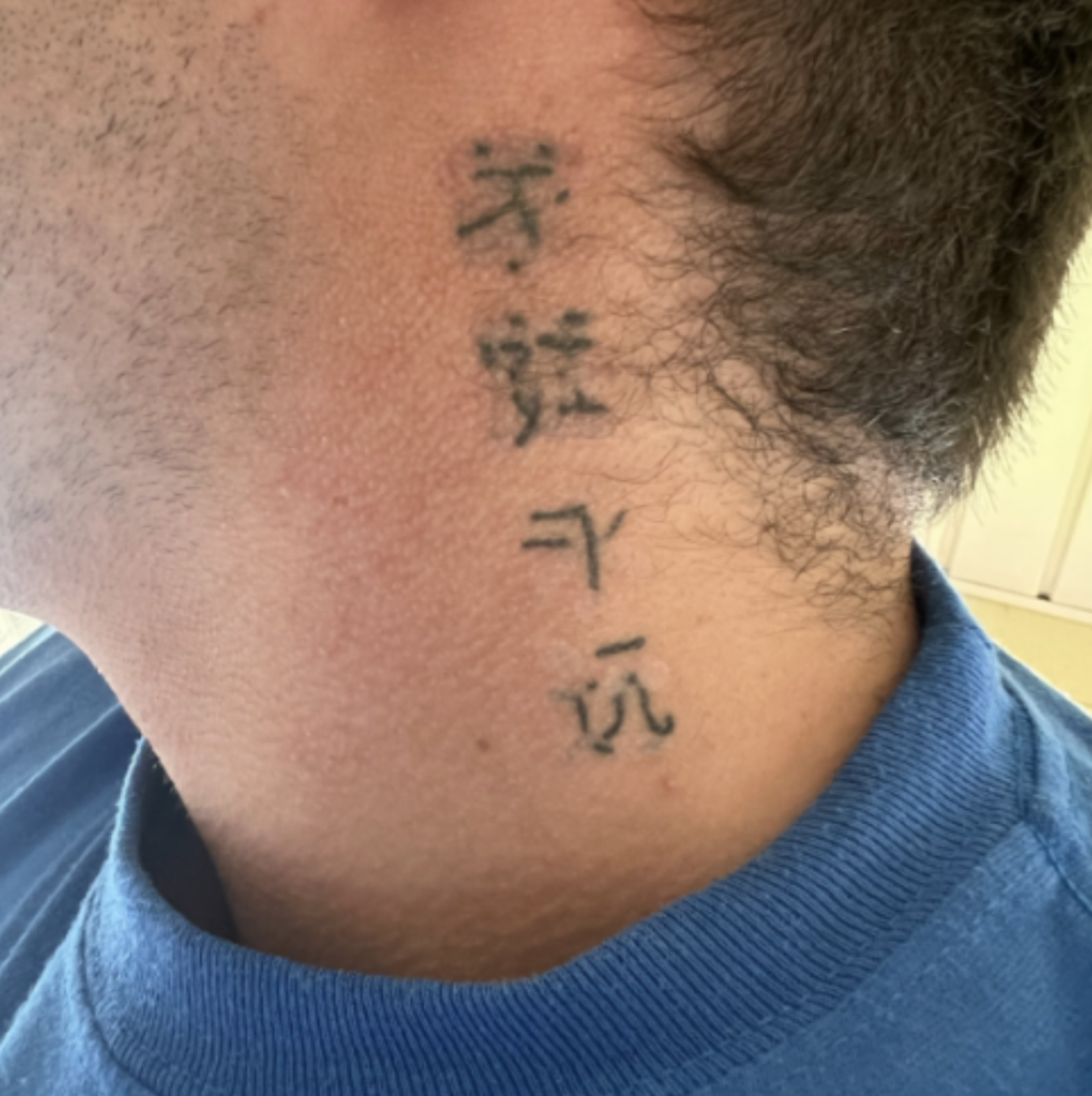chinese word tattoo removal