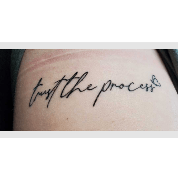 Tattoo Removal Before and After Pictures Tatt2Away®