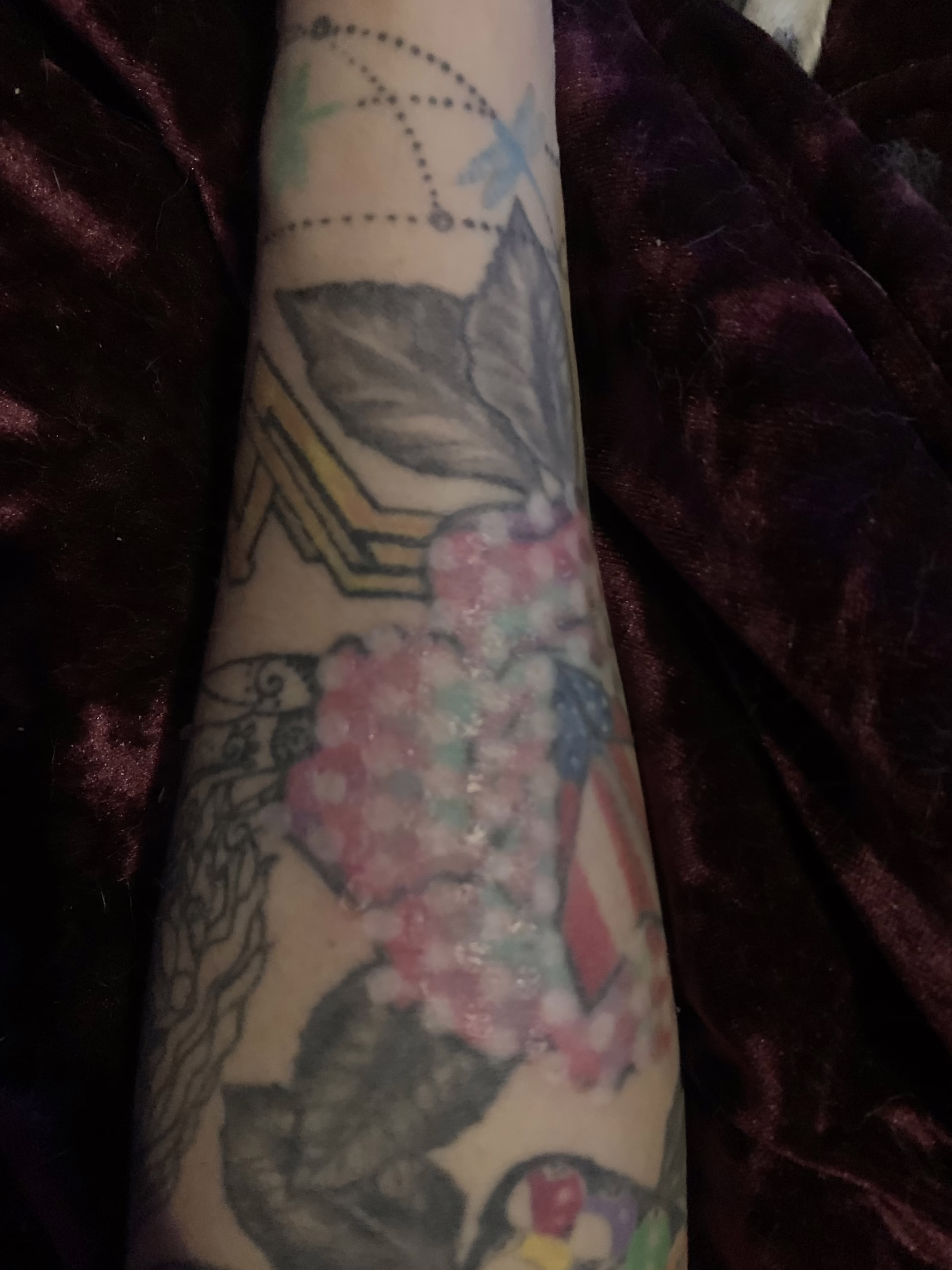 19 days after tattoo removal treatment 19 days after tattoo removal treatment