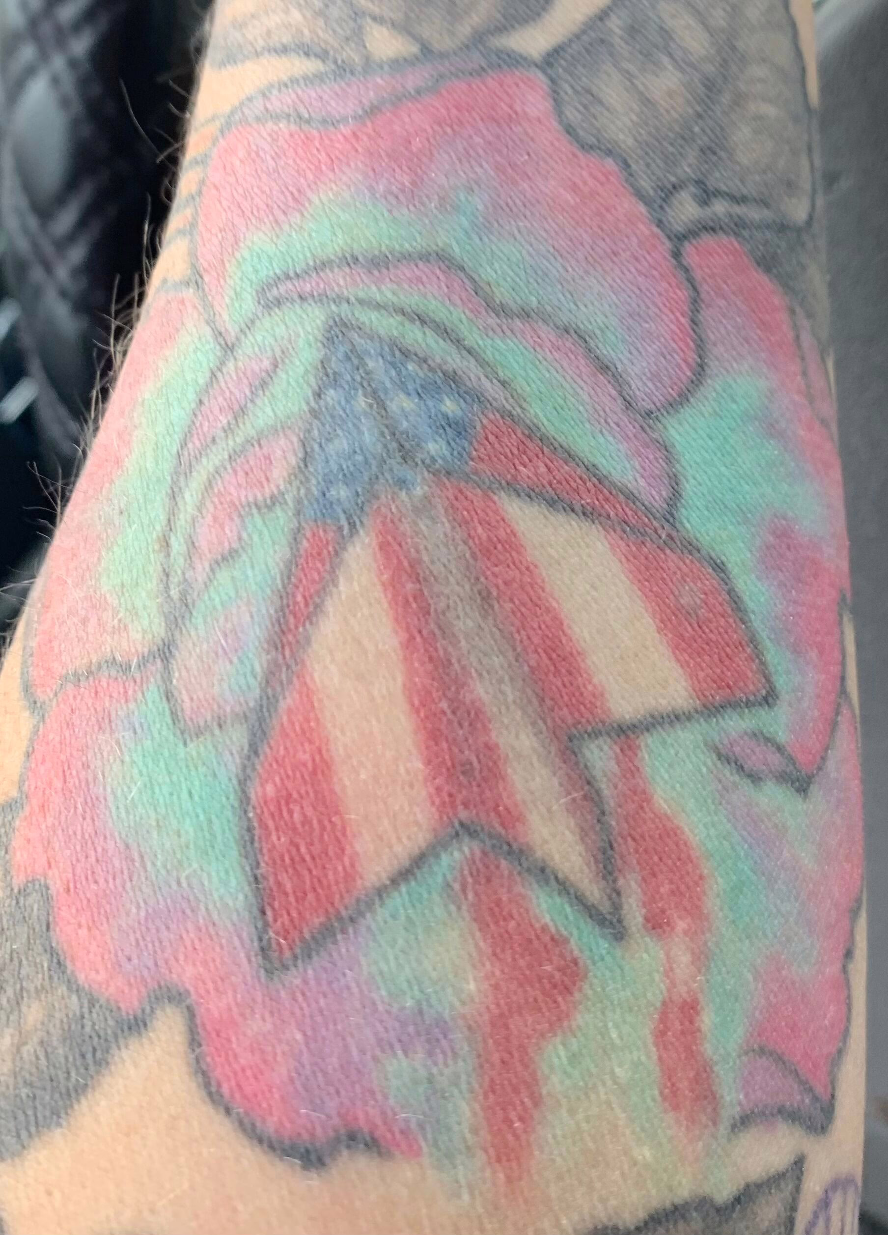 tatt2away tattoo removal results preparation before tattoo removal